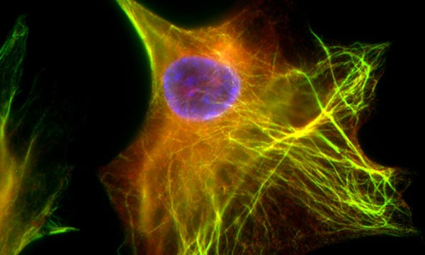 Fluorescence Microscopy