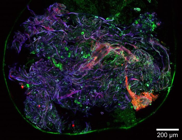 Granular detail: Femtosecond lasers were used to produce this multiphoton microscopy image of lung tissue. (Source: M L Groot, VU Amsterdam/Flash Pathology BV)